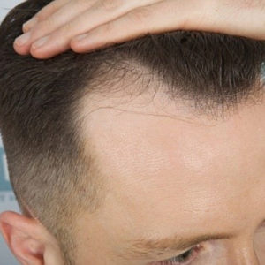 92 Imagenes Cortes De Pelo De Hombre Con Lineas 2019 Free Descargar